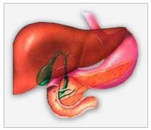 What is liver cirrhosis?