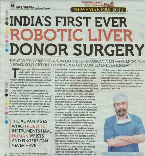 India's first Robotic Liver Surgery
