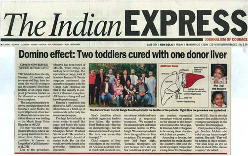 Domino effect : Two Toddlers cured with one donor liver