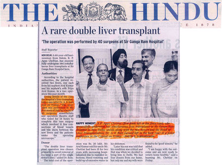 A rare double liver transplant
