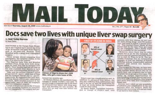 Docs save two lives unique liver swap surgery