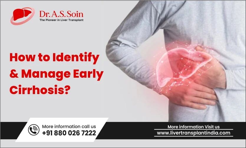 How to Identify and Manage Early Cirrhosis