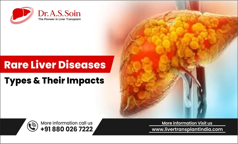 Rare Liver Diseases: Varieties and Their Impacts