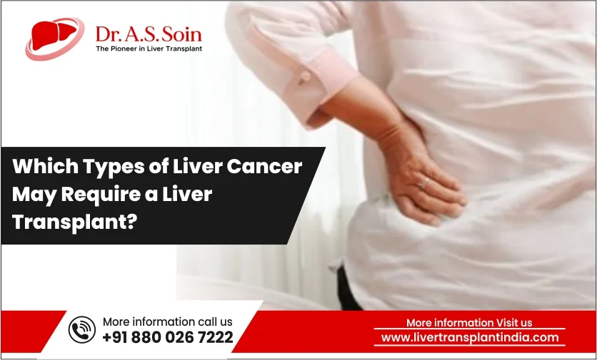 Which Types of Liver Cancer May Require a Liver Transplant?