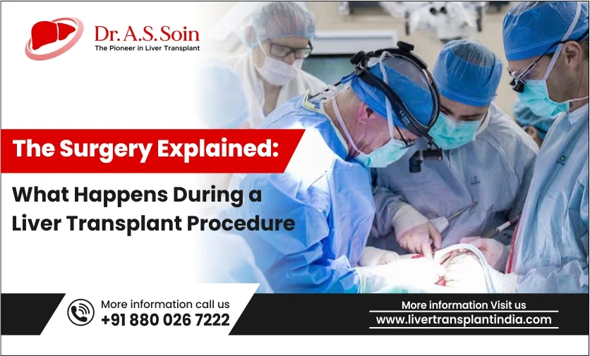 Understanding Liver Transplant Surgery: A Step-by-Step Guide