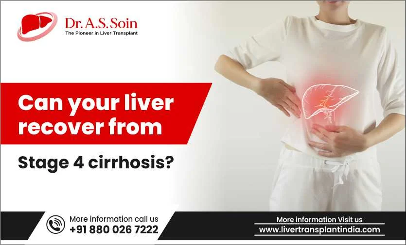 Can Your Liver Recover From Stage 4 Cirrhosis?