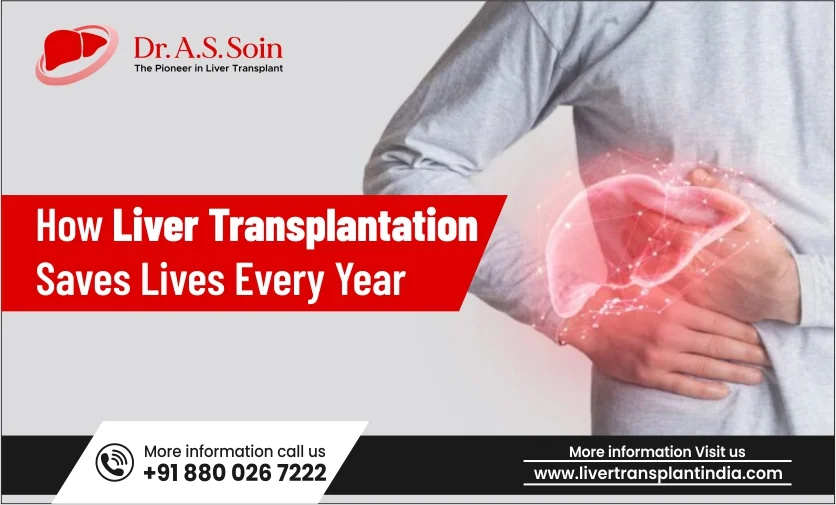 How Liver Transplantation Saves Lives Every Year