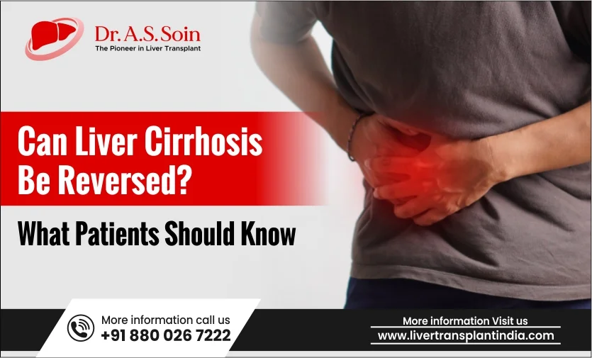 Can Liver Cirrhosis Be Reversed? What Patients Should Know