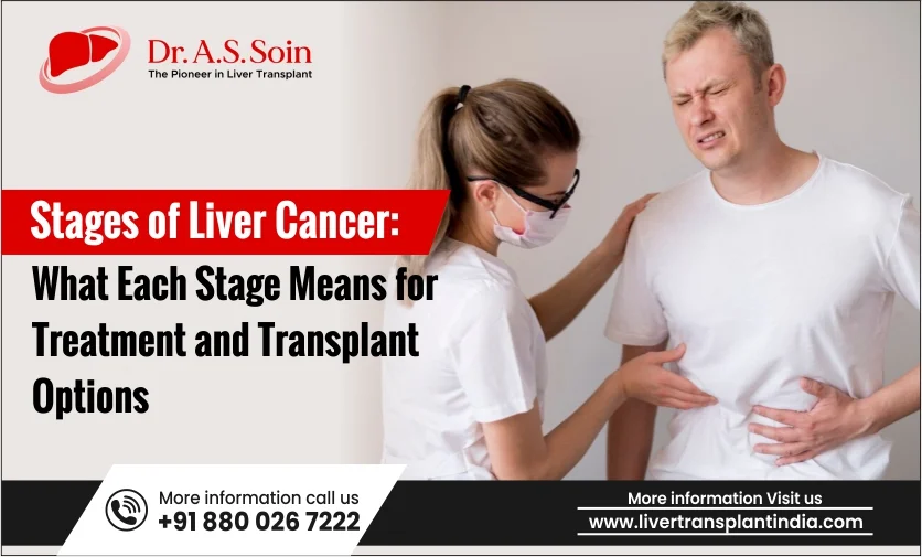 Stages of Liver Cancer: What Each Stage Means for Treatment and Transplant Options | Liver Cancer Treatment in India