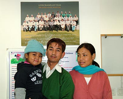 Best liver Transplant in India