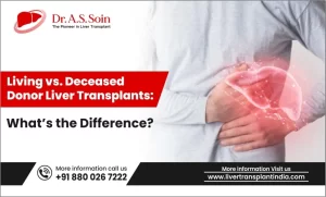 Liver Transplants