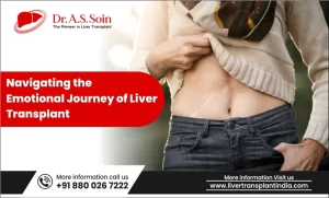 Journey of Liver Transplant Patients