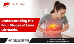 Liver Cirrhosis