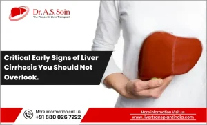Early Signs of Liver Cirrhosis
