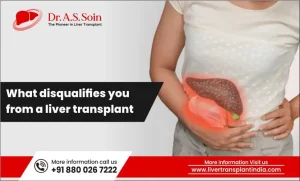 Liver Transplant