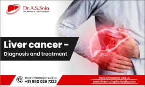 Liver Cancer