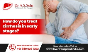 Treating Early-Stage (Compensated) Cirrhosis