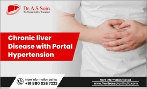 Chronic Liver Disease