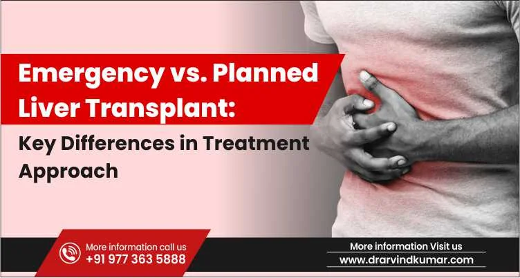 Liver Transplant
