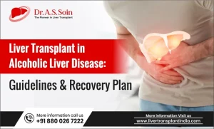 Liver Transplant in Alcoholic Liver Disease