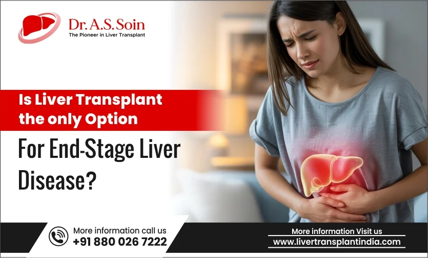 Is Liver Transplant the Only Option for End-Stage Liver Disease
